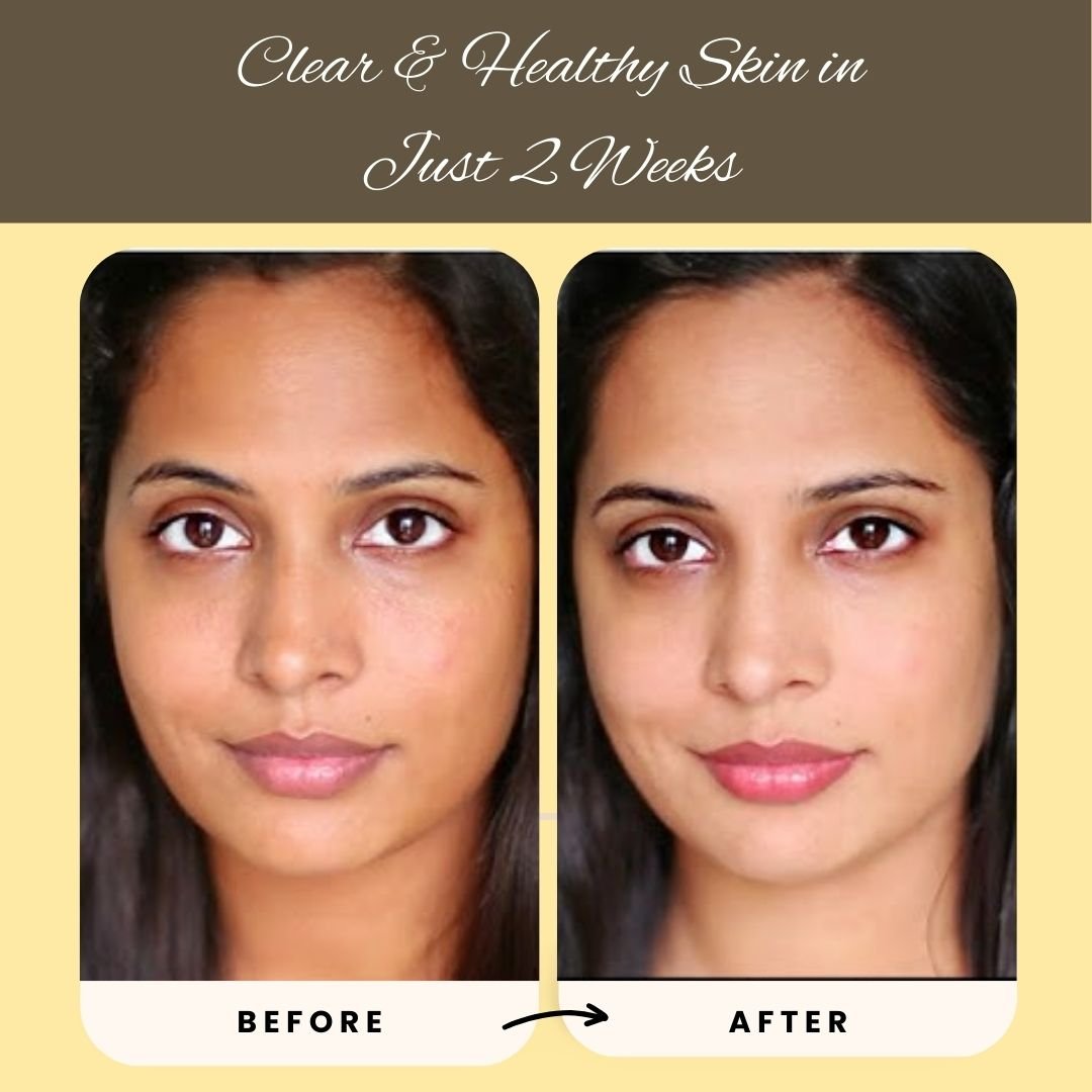 Mooligai Kuliyal Powder Grade 2 - KSC 4